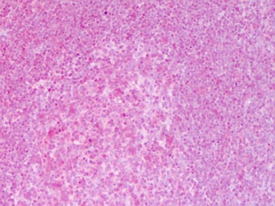 NFkB p65 Antibody in Immunohistochemistry (Paraffin) (IHC (P))