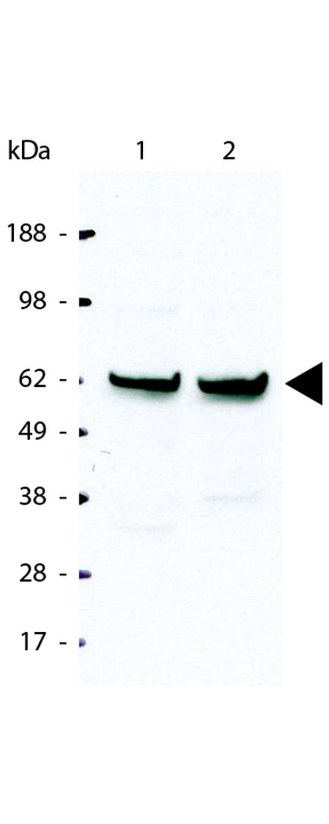 NFkB p65 Antibody in Western Blot (WB)