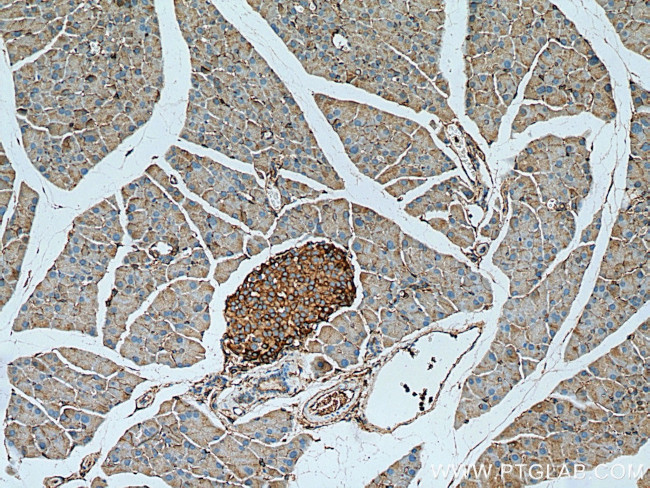 Marcks Antibody in Immunohistochemistry (Paraffin) (IHC (P))