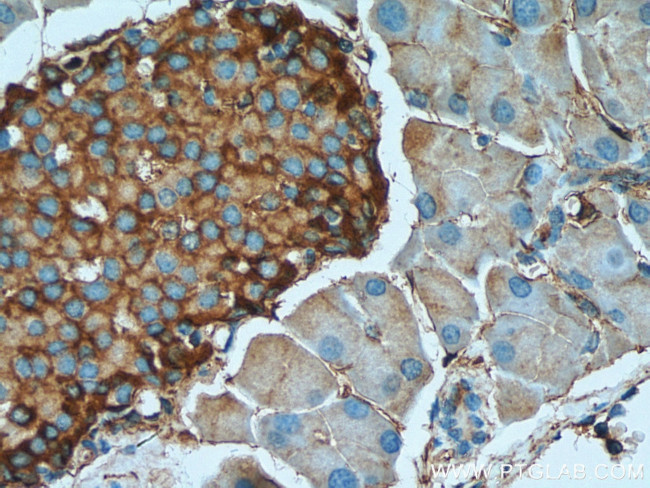 Marcks Antibody in Immunohistochemistry (Paraffin) (IHC (P))