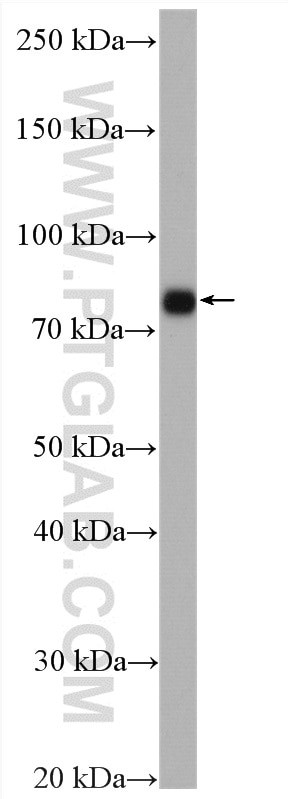 Marcks Antibody in Western Blot (WB)