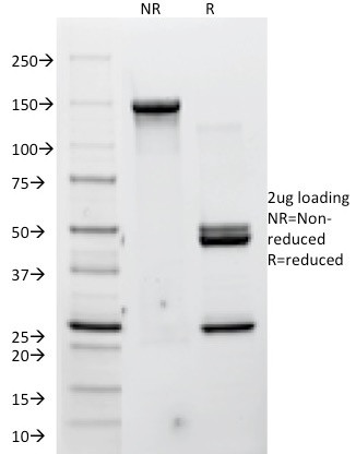 P-Cadherin (CDH3) Antibody in SDS-PAGE (SDS-PAGE)