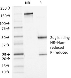 P-Cadherin (CDH3) Antibody in SDS-PAGE (SDS-PAGE)