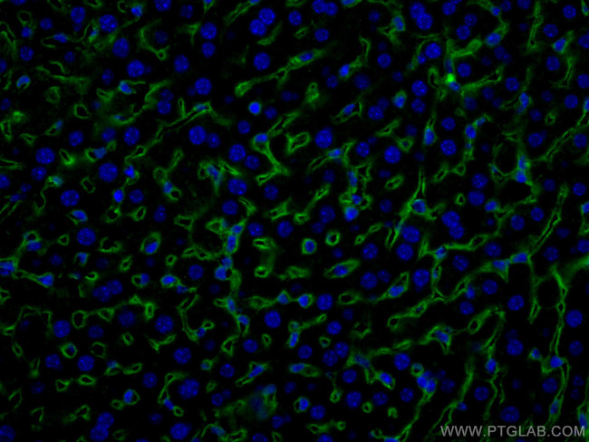 Icam-1 Antibody in Immunohistochemistry (PFA fixed) (IHC (PFA))