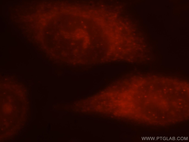 5 Lipoxygenase Antibody in Immunocytochemistry (ICC/IF)