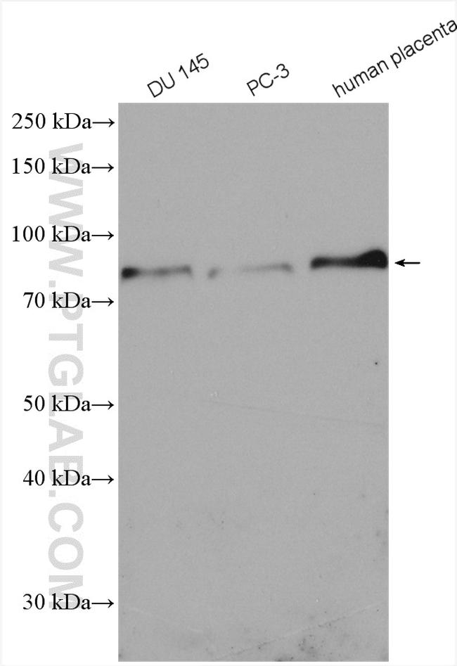 5 Lipoxygenase Antibody in Western Blot (WB)