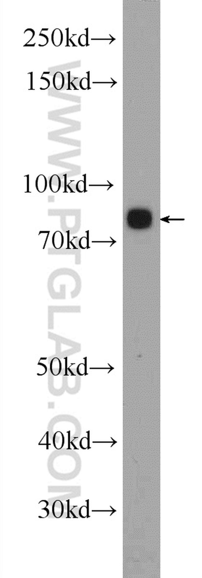 5 Lipoxygenase Antibody in Western Blot (WB)