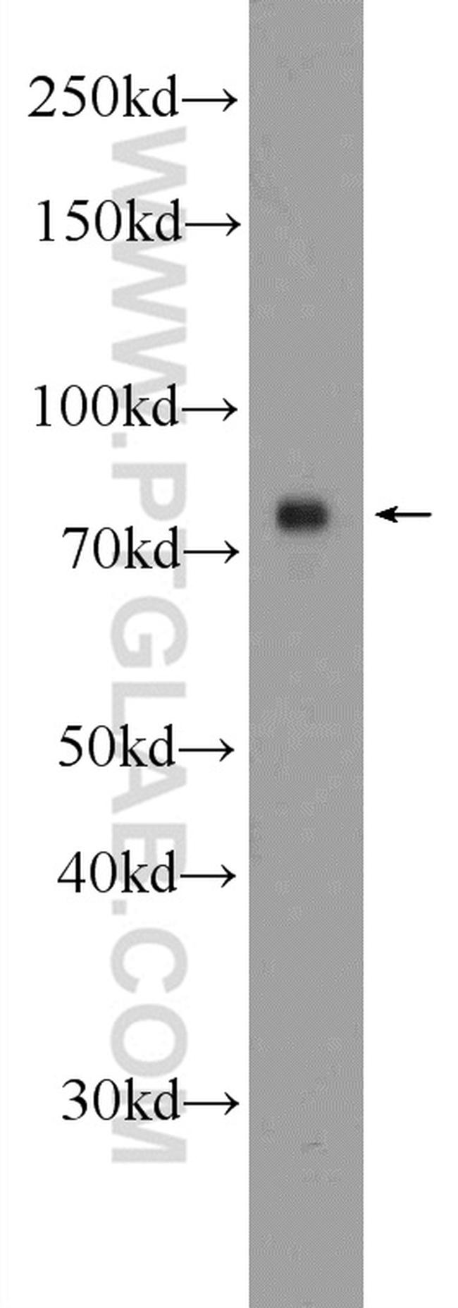 5 Lipoxygenase Antibody in Western Blot (WB)