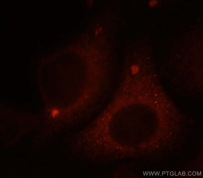 cIAP1 Antibody in Immunocytochemistry (ICC/IF)