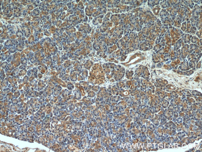 cIAP1 Antibody in Immunohistochemistry (Paraffin) (IHC (P))