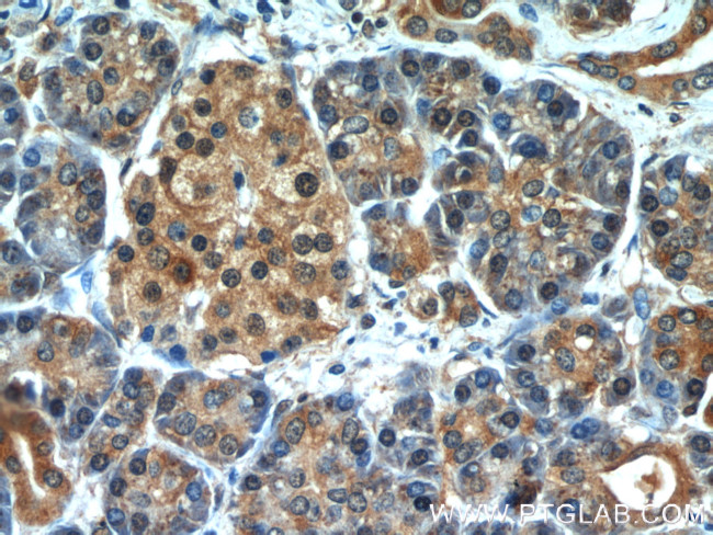 cIAP1 Antibody in Immunohistochemistry (Paraffin) (IHC (P))