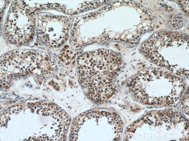 cIAP1 Antibody in Immunohistochemistry (Paraffin) (IHC (P))