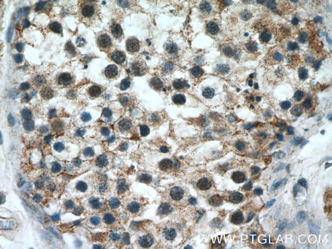 cIAP1 Antibody in Immunohistochemistry (Paraffin) (IHC (P))