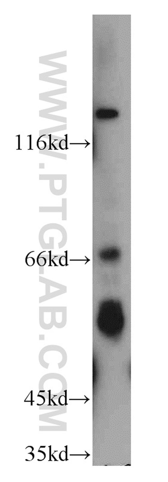 cIAP1 Antibody in Western Blot (WB)