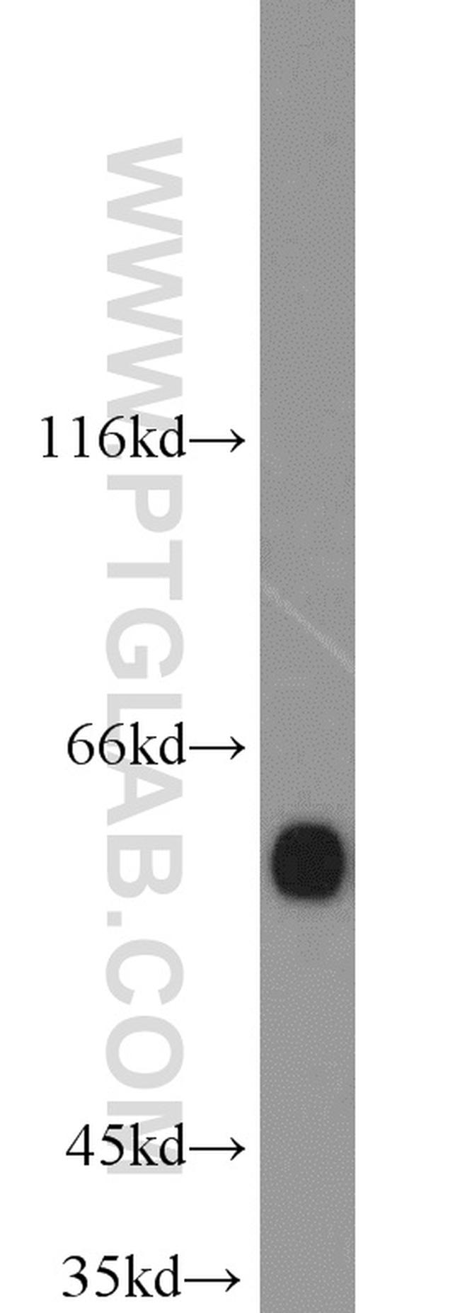 cIAP1 Antibody in Western Blot (WB)