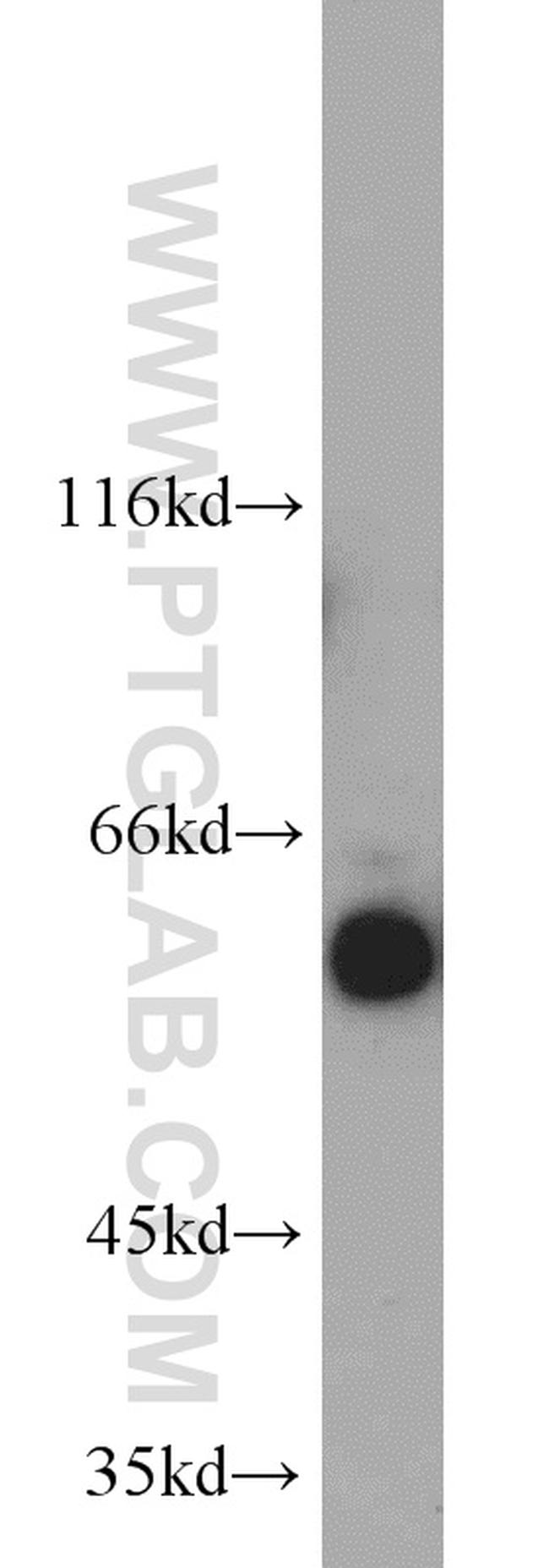 cIAP1 Antibody in Western Blot (WB)