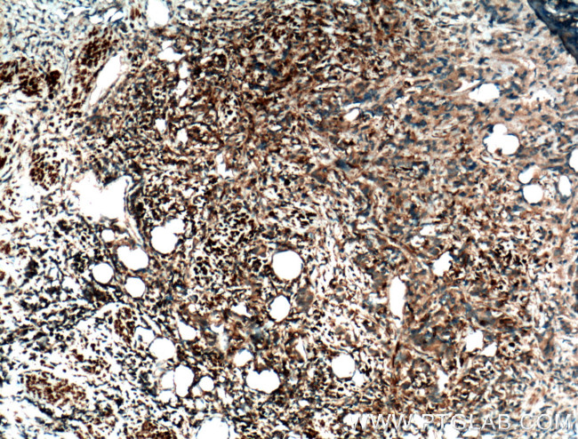 JNK Antibody in Immunohistochemistry (Paraffin) (IHC (P))