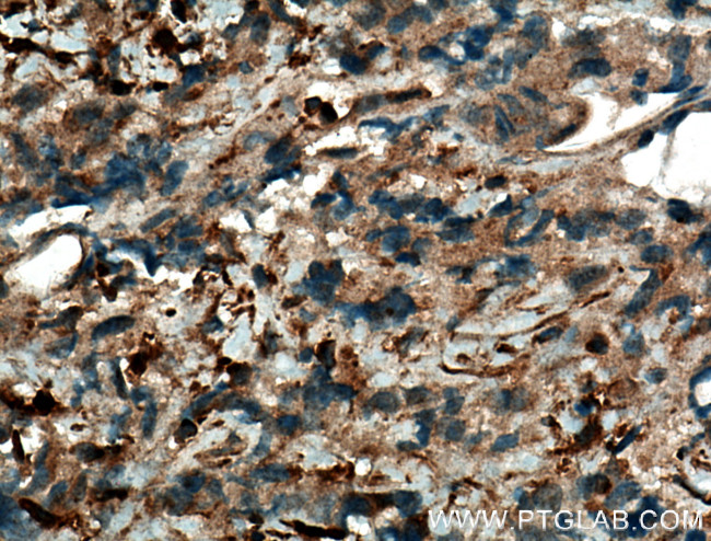 JNK Antibody in Immunohistochemistry (Paraffin) (IHC (P))