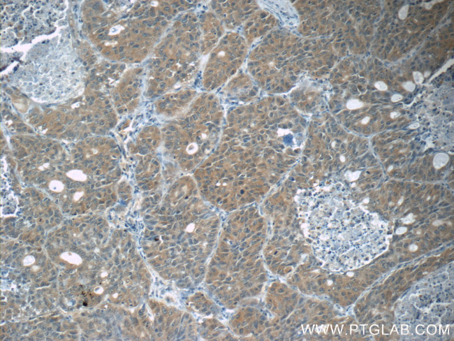 JNK Antibody in Immunohistochemistry (Paraffin) (IHC (P))