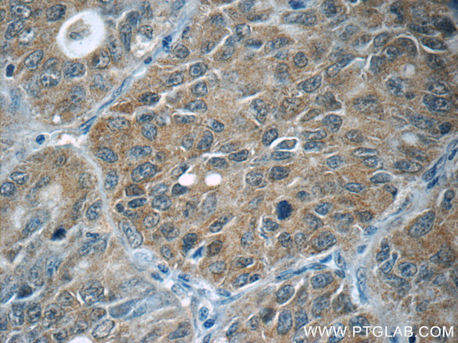 JNK Antibody in Immunohistochemistry (Paraffin) (IHC (P))