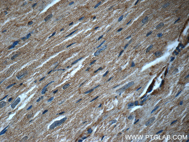 JNK Antibody in Immunohistochemistry (Paraffin) (IHC (P))