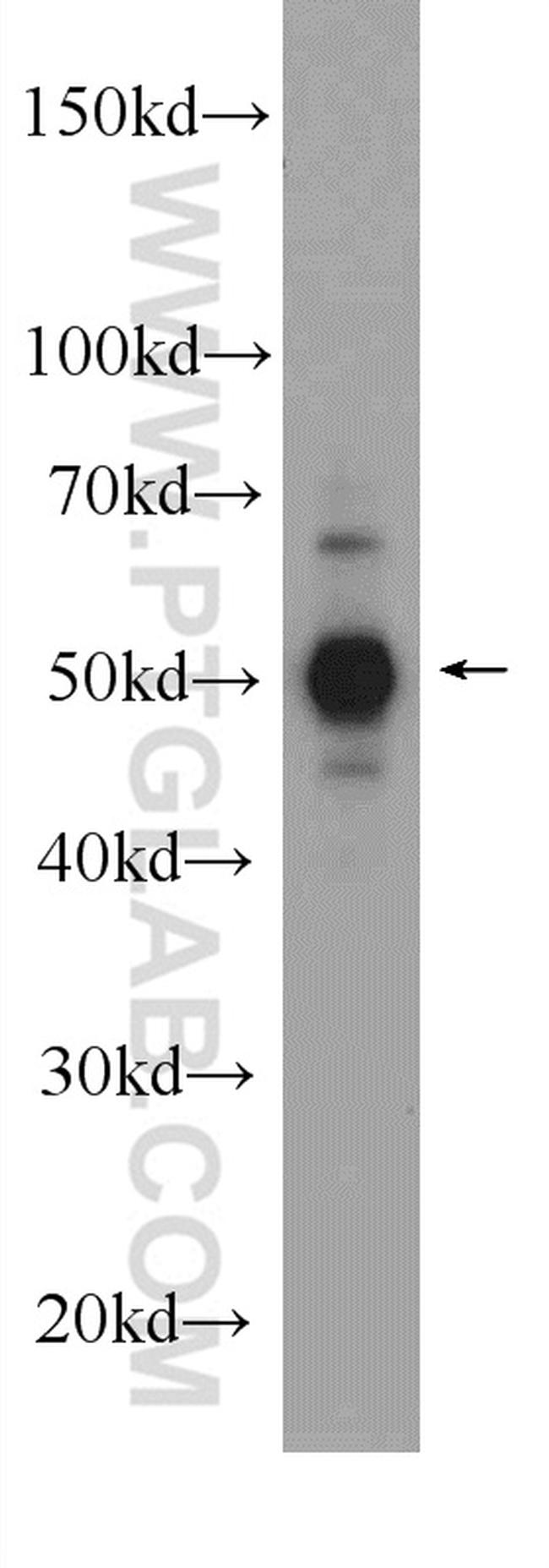 JNK Antibody in Western Blot (WB)