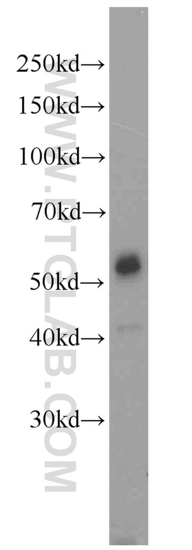 JNK Antibody in Western Blot (WB)