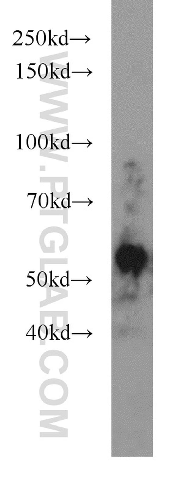 JNK Antibody in Western Blot (WB)