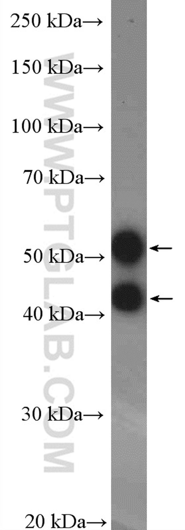 JNK Antibody in Western Blot (WB)