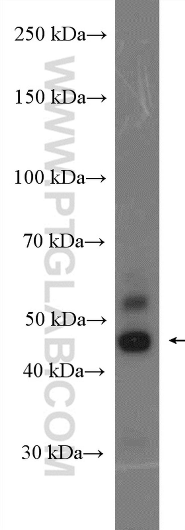 JNK Antibody in Western Blot (WB)