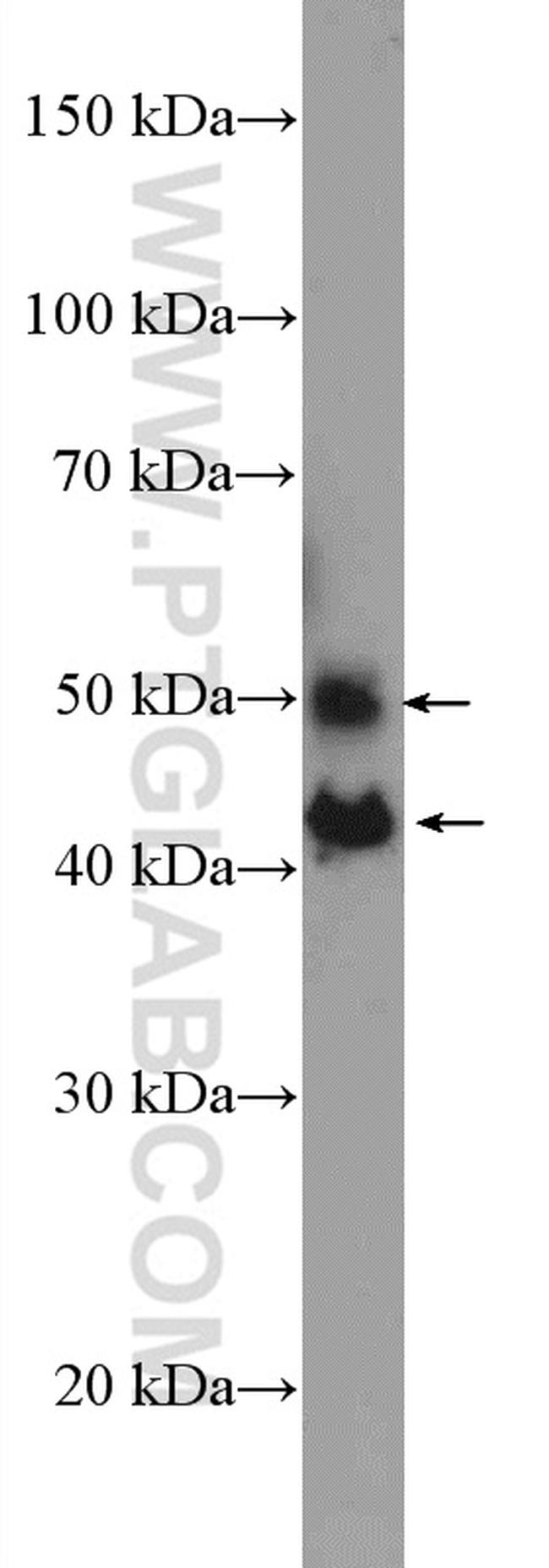 JNK Antibody in Western Blot (WB)