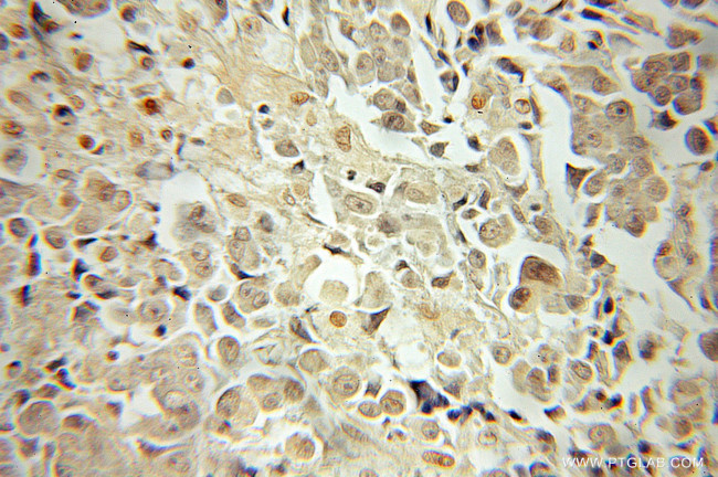 JNK Antibody in Immunohistochemistry (Paraffin) (IHC (P))