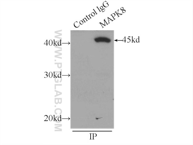 JNK Antibody in Immunoprecipitation (IP)