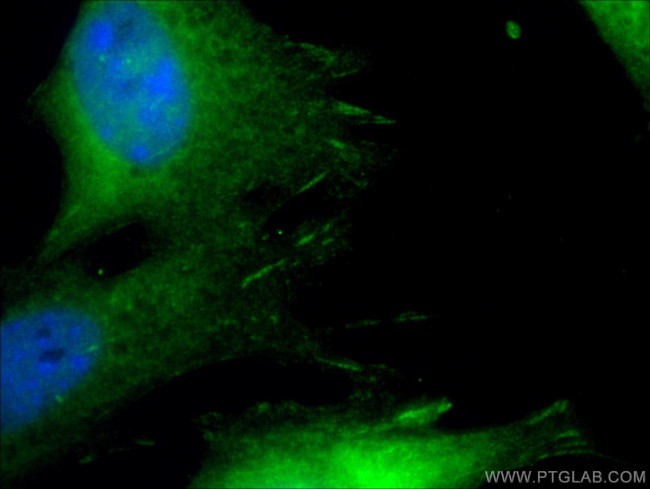 Paxillin Antibody in Immunocytochemistry (ICC/IF)