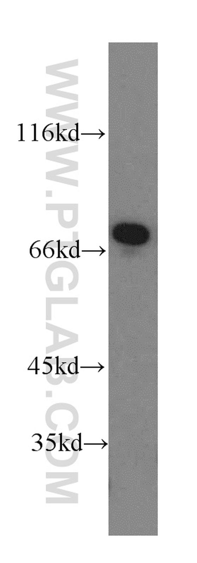 Paxillin Antibody in Western Blot (WB)