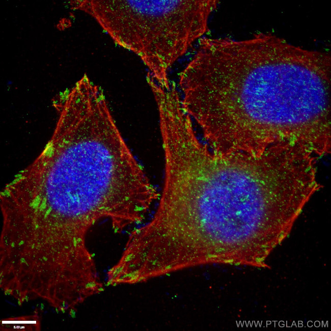 Paxillin Antibody in Immunocytochemistry (ICC/IF)