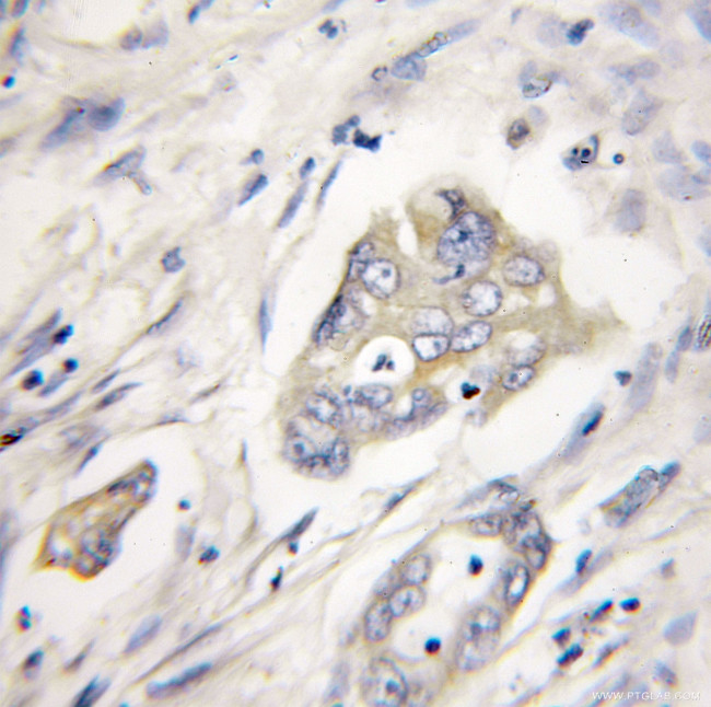 XIAP Antibody in Immunohistochemistry (Paraffin) (IHC (P))