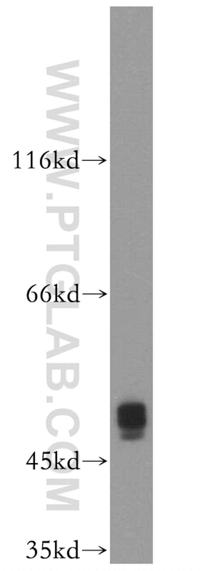 XIAP Antibody in Western Blot (WB)