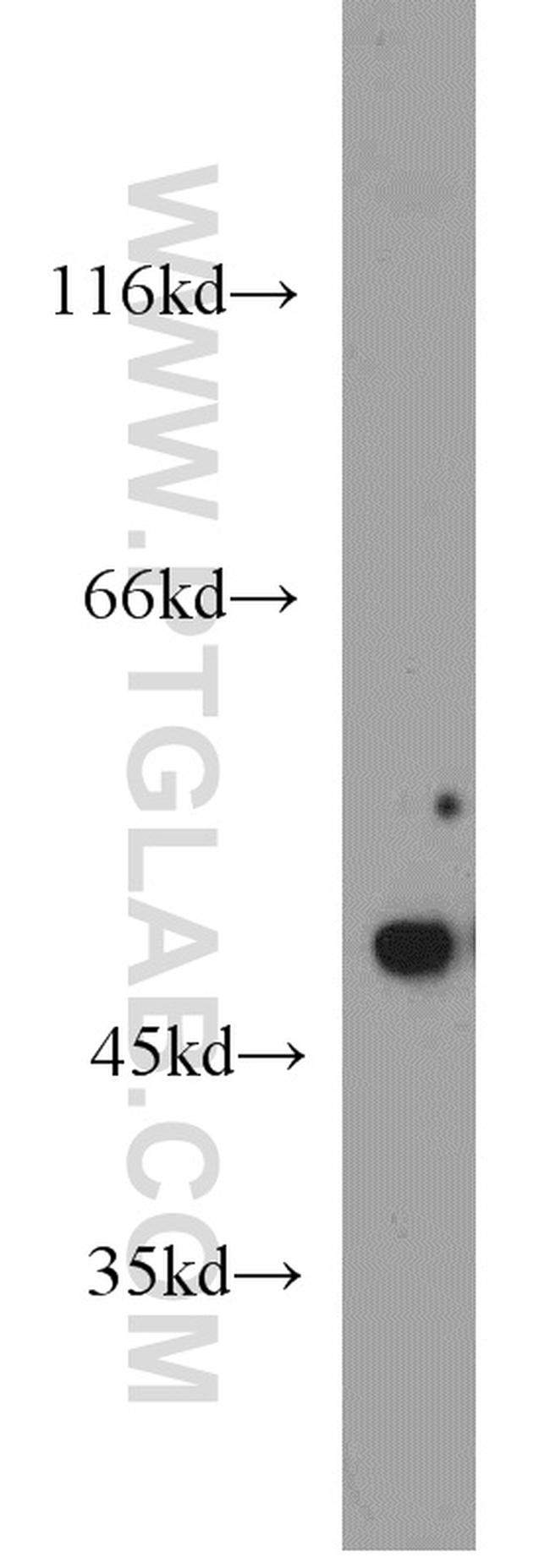 XIAP Antibody in Western Blot (WB)