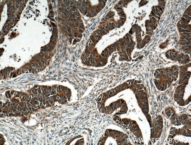 GRB7 Antibody in Immunohistochemistry (Paraffin) (IHC (P))