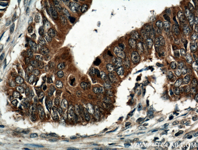 GRB7 Antibody in Immunohistochemistry (Paraffin) (IHC (P))