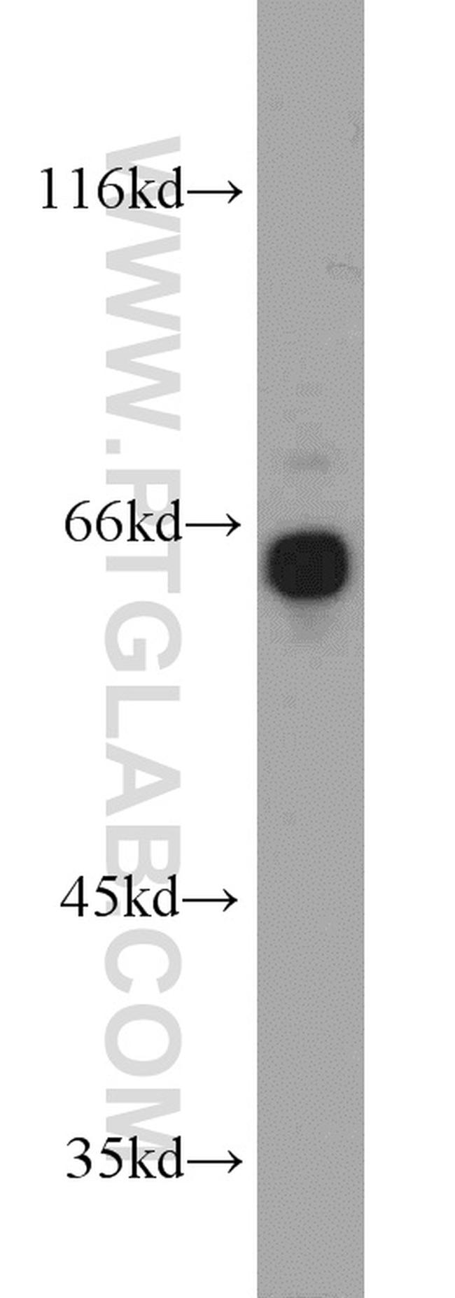 GRB7 Antibody in Western Blot (WB)