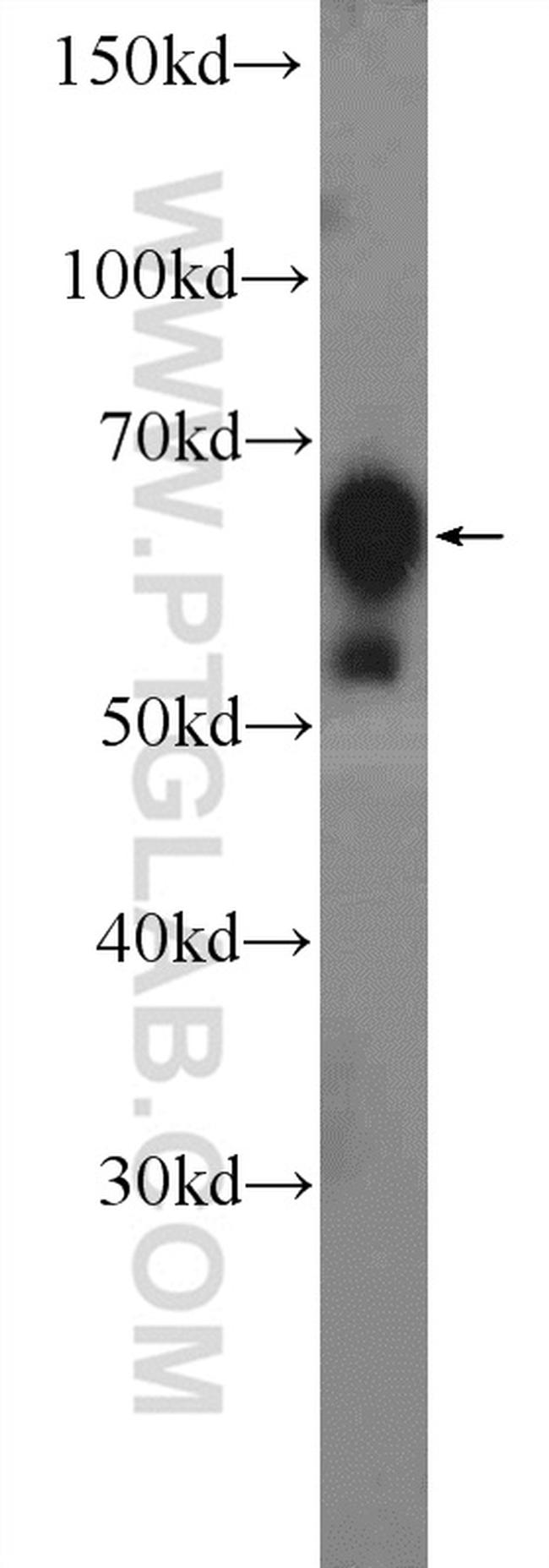 GRB7 Antibody in Western Blot (WB)