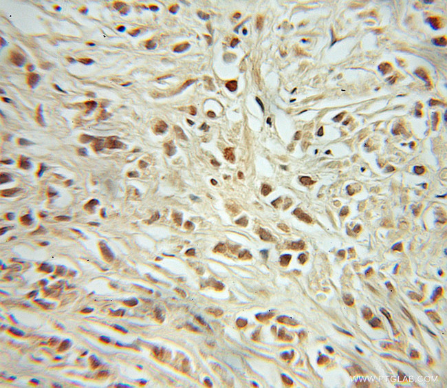 RB1 Antibody in Immunohistochemistry (Paraffin) (IHC (P))