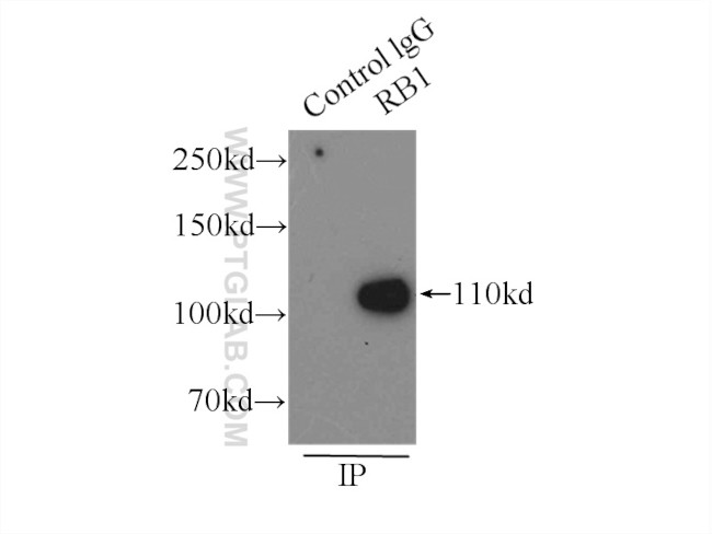 RB1 Antibody in Immunoprecipitation (IP)