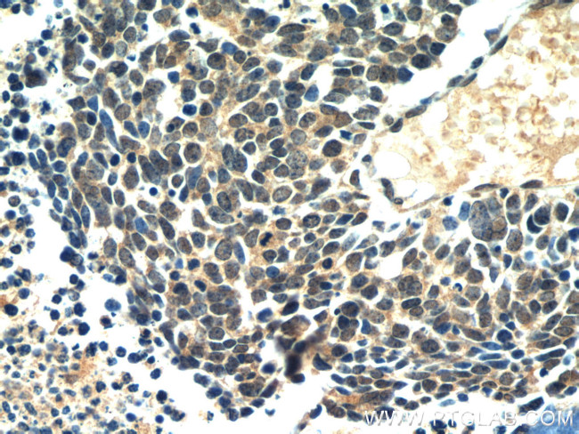 RB1 Antibody in Immunohistochemistry (Paraffin) (IHC (P))