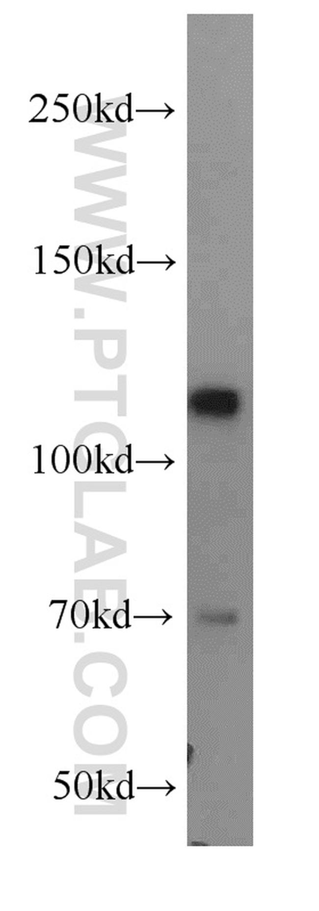 RB1 Antibody in Western Blot (WB)