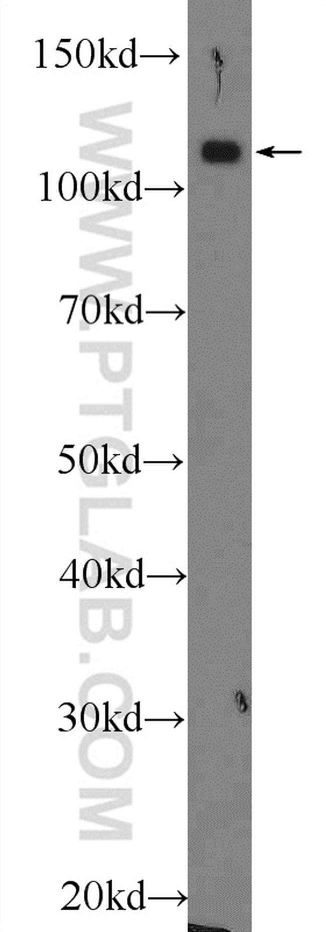 RB1 Antibody in Western Blot (WB)