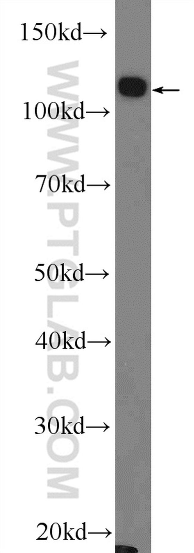 RB1 Antibody in Western Blot (WB)