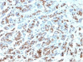 MICA Antibody in Immunohistochemistry (Paraffin) (IHC (P))